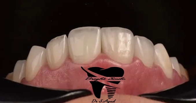 Nouveau sourire, nouvelle vie - Transformation 5